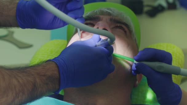 Proceso de tratamiento del canal radicular. Doctor manos taladrar dientes — Vídeos de Stock