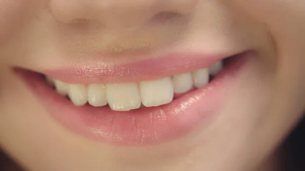 Bouche féminine souriante aux dents blanches. Gros plan visage de femme avec sourire parfait — Photo