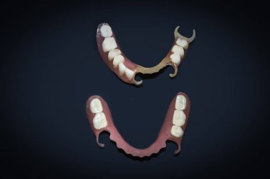 Removable dentures flexible, devoid of nylon, hypoallergenic exempt from monomer. clipart