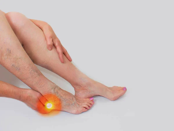 Fußsohle mit roten beschädigten Spitzen. Gesundheitskonzept — Stockfoto
