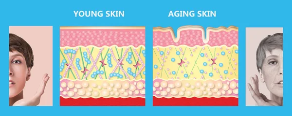 Jüngere Haut und alternde Haut. Elastin und Kollagen. — Stockfoto