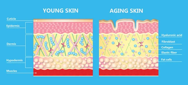 Le diagramme de la peau plus jeune et de la peau vieillissante — Photo