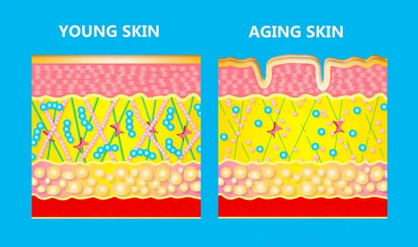 Діаграма молодшої шкіри та старіння шкіри — стокове фото