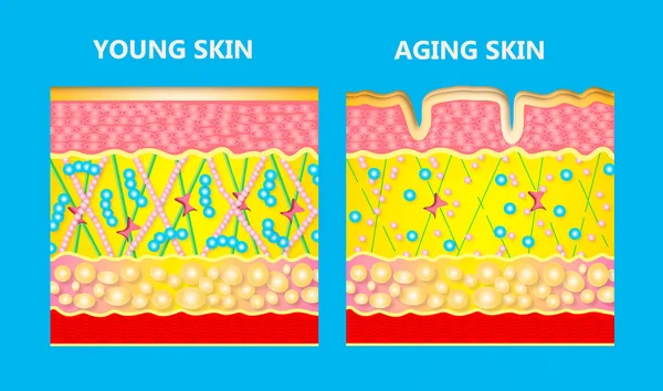 젊은 피부와 피부 노화의 다이어그램 — 스톡 사진