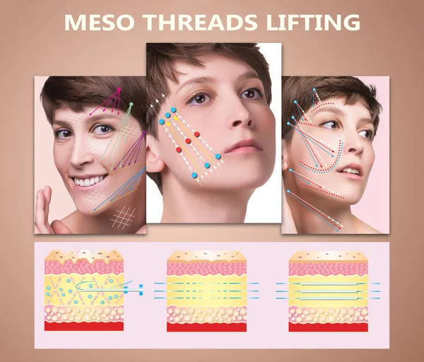 Meso thread lift. junge Hündin mit sauberer, frischer Haut. schöne Frau. Gesicht und Hals. — Stockfoto
