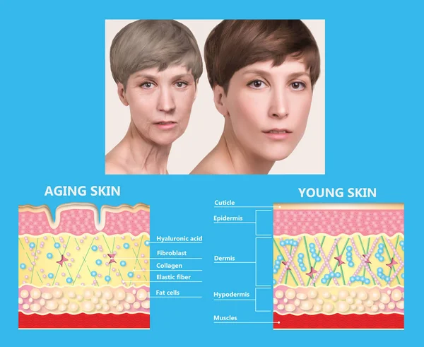 younger skin and aging skin. elastin and collagen.