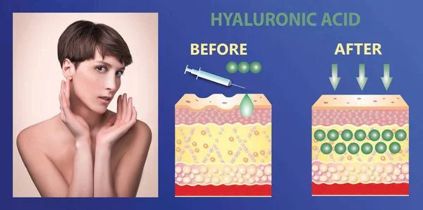 Hyaluronsäure. Hautpflegeprodukte. Hautverjüngung — Stockfoto