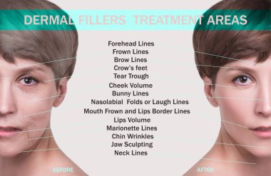 Yaşlanma karşıtı, güzellik tedavisi, yaşlanma ve gençlik, kaldırma, cilt bakımı, estetik ameliyat konsepti.