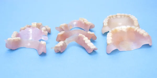 Dentiere rimovibili flessibili, prive di nylon, ipoallergeniche esenti da monomero . — Foto Stock
