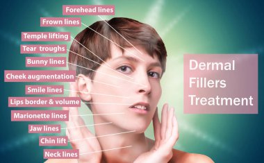 Kırışıklık önleyici iğne için tedavi alanları. Temiz ve taze ciltli genç bir kadın. Güzel kadın. Yüz ve boyun. Kafkasyalı genç bir modelin portresi. Kaldırma ve doldurma kavramı