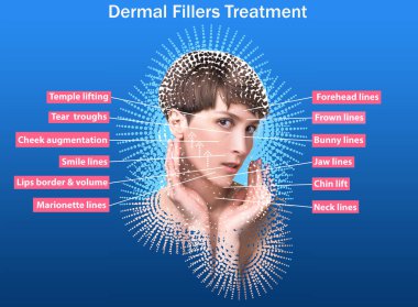 Kırışıklık önleyici iğne için tedavi alanları. Temiz ve taze ciltli genç bir kadın. Güzel kadın. Yüz ve boyun. Kafkasyalı genç bir modelin portresi. Kaldırma ve doldurma kavramı