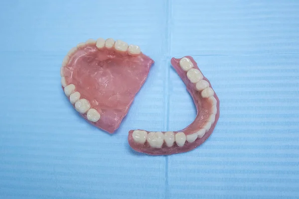 Знімні Зубні Протези Гнучкі Позбавлені Нейлону Гіпоалергенні Звільнені Від Мономеру — стокове фото