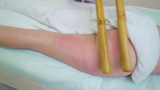 Сверху вниз антицеллюлитного массажа с бамбуковыми палочками на ягодицах и бедрах женщины — стоковое видео