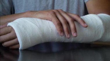Alçıya sarılı kırık kol için kendine masaj yapan bir adam.