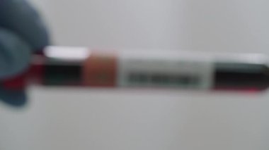 Negatif SARS-COV2 test sonucu, salgını durdurmak için başarılı aşı geliştirme