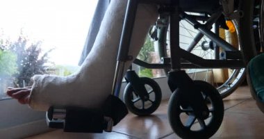 Hastanın hastanede kırık bacakla 