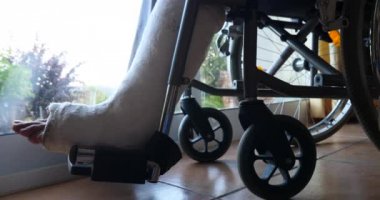 Hastanın hastanede kırık bacakla 