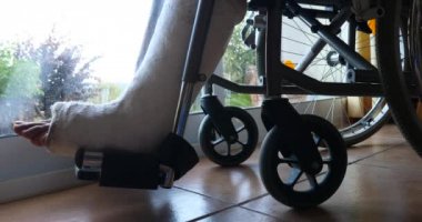 Hastanın hastanede kırık bacakla 