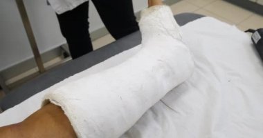 Doktor Hemşire sıva özel tıbbi ekipman ile kırık kemik bacak kaldırma  