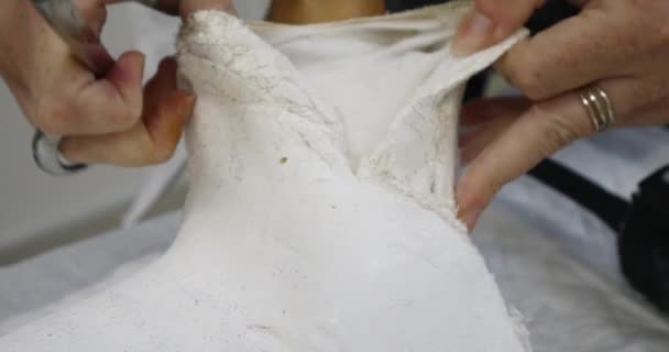 Лікар Медсестра Видаляє Штукатурку Зламаній Нозі Спеціалізованим Медичним Обладнанням — стокове відео