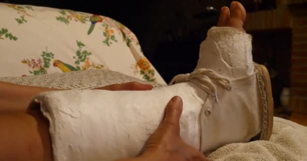 Benet Gips Avgjutning Kvinnlig Patient — Stockvideo