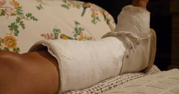 Πόδι Ένα Εκμαγείο Της Γυναίκας Ασθενούς — Αρχείο Βίντεο