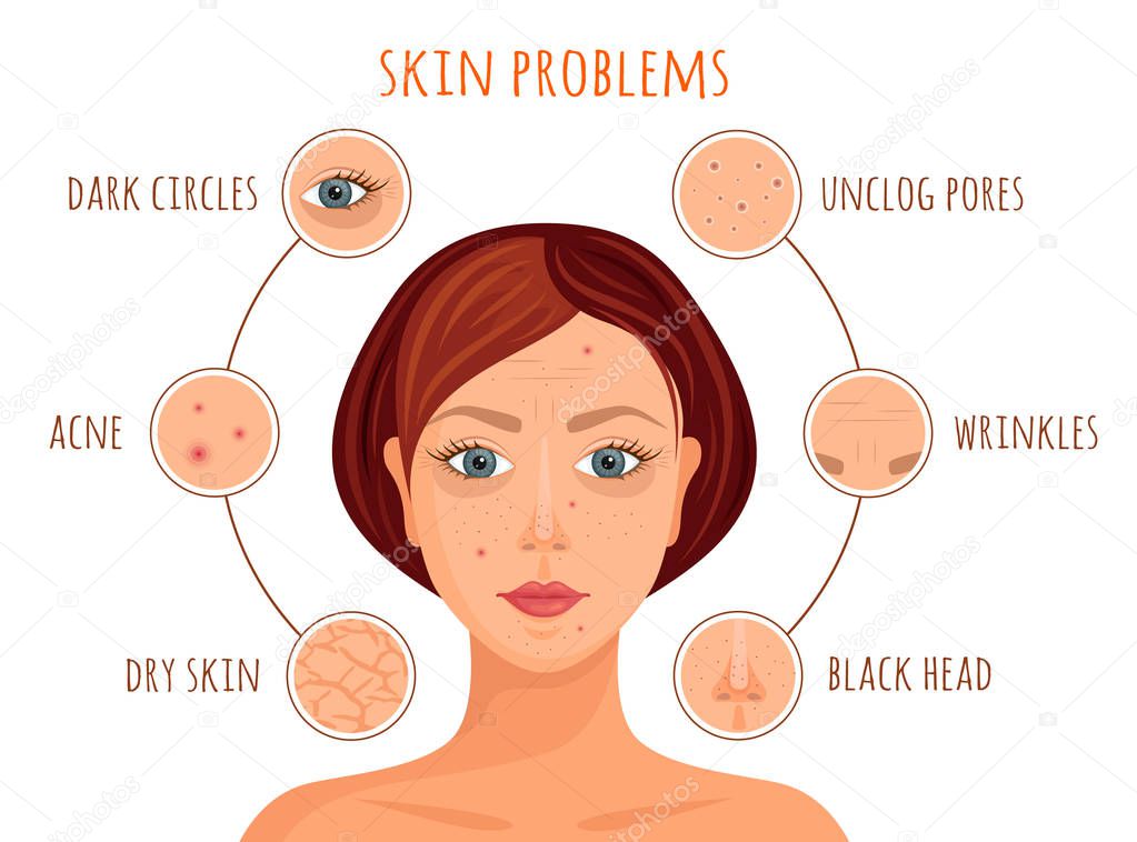 Skin problems. Infographics. Vector.