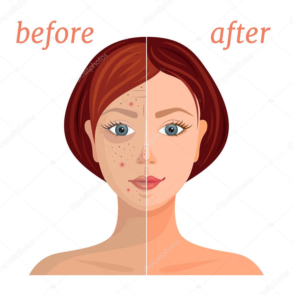 Banner with the image of a woman's face before and after the application of cosmetics. Comparison of problematic dull skin and healthy, clean. Vector illustration.