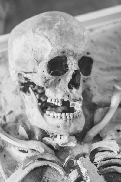 人間の頭蓋骨の嘘 — ストック写真