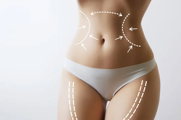 妇女身体与标记在胃 — 图库照片