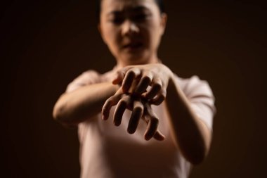 Asyalı kadın cildini kaşındıran, cildini kaşıyan, bej arka planda tek başına duran hasta bir kadındı..