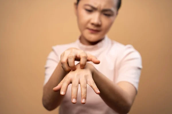 亚洲女人因恼怒地瘙痒皮肤 挠皮肤 因米色背景孤立无援而感到恶心 — 图库照片