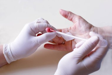 Doktor hasta parmağından kan örneği alır.