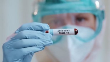Covid-19 Coronavirus hastasının antikorlarıyla kan testi yapılan bir laboratuvar.
