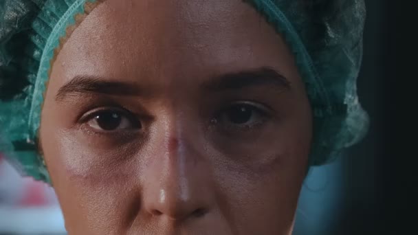 Женщина врач на ее лице следы видны из защитной маски, красные пятна — стоковое видео