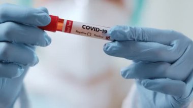 Kan testine bakan tıbbi işçilerin yakınlaşması sonucu COVID-19 pozitif.