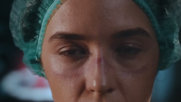 Vrouwelijke arts heeft schaafwonden op het gezicht van beschermende masker en medische bril — Stockvideo