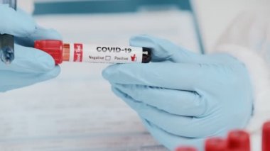 COVID-19 pozitif kan testiyle doktorların ellerindeki tüpü kapatın.