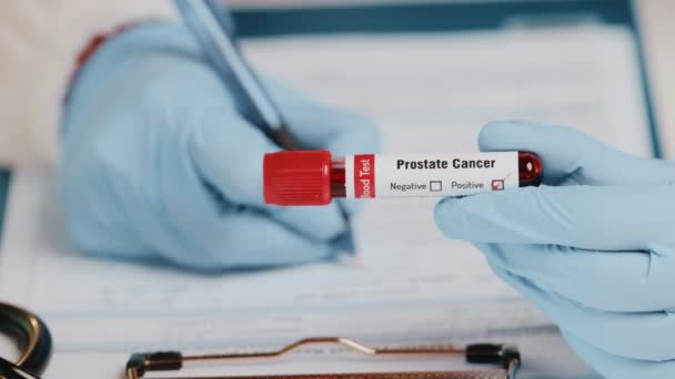 De arts houdt hand laboratorium positieve bloed reageerbuis voor kanker prostaat — Stockvideo