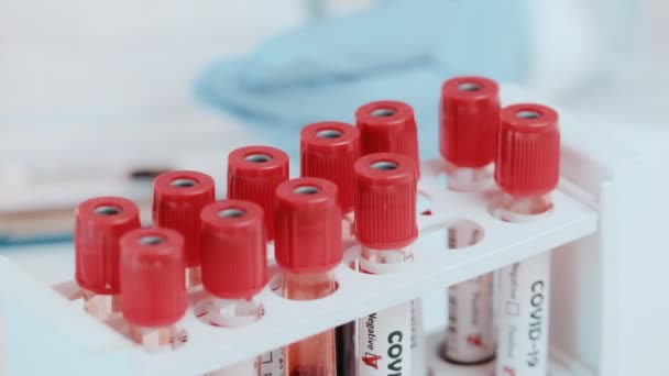 Primer plano de los médicos que sostienen el tubo con un análisis de sangre positivo para COVID-19 — Vídeo de stock