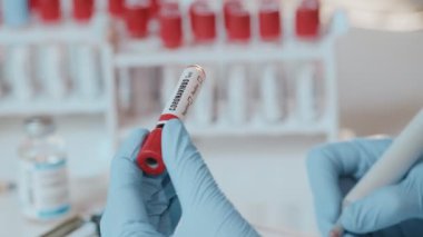 Coronavirus Covid 19, doktorun elindeki numune tüpünde enfekte olmuş kan örneği.