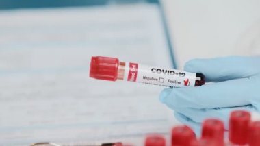 Doktorun eli pozitif COVID-19 analiziyle test tüpünü tutuyor.