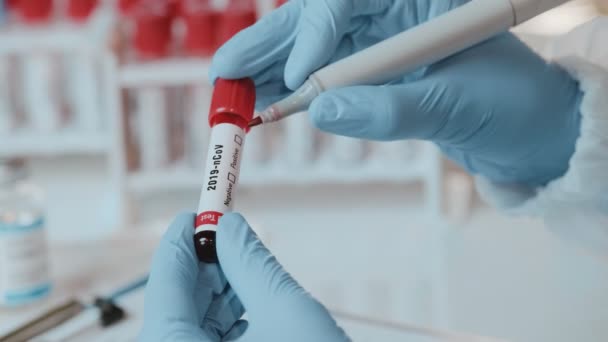 O médico observa um resultado positivo para a presença de corpos COVID-19 no tubo de ensaio — Vídeo de Stock