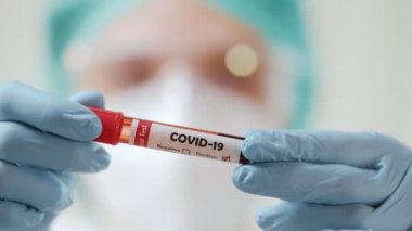Kadın doktor COVID-19 virüsünün kan örneğini kontrol etmek için kan testi tüpü tutuyor..