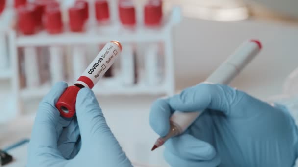 Close-up de médicos mão segurando tubo com teste de sangue positivo para COVID-20 — Vídeo de Stock
