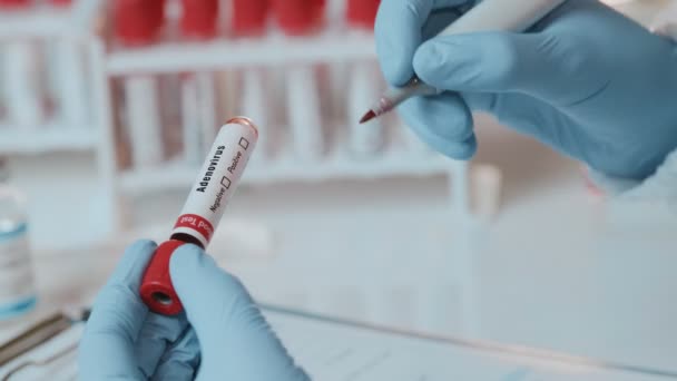 O médico detém amostra de sangue da mão positiva com Adenovirus — Vídeo de Stock