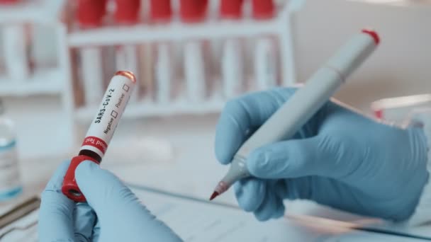 Крупный план врачей, держащих трубку с положительным анализом крови на SARS-CoV-2 — стоковое видео