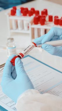 SARS-CoV-3 kan testine tabi tutulan doktorların el tüplerini dikey olarak kapatın.