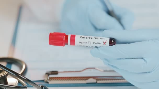 Dokter memegang di laboratorium tangan positif tes darah tabung dengan enterovirus — Stok Video