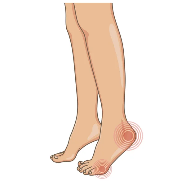 Pierna imágenes de stock de arte vectorial | Depositphotos Pierna imágenes de stock de arte vectorial | Depositphotos